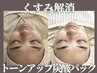 ニキビケア×毛穴★選べる炭酸パック+毛穴洗浄（Tゾーン小鼻)¥6600