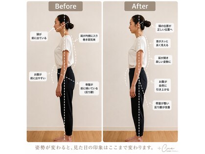 美容整体プラスキュー五反田の写真
