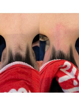 ロア(ROA)/うなじワックス