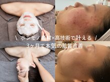 ヒュッゲサロン(HYGGE Salon)の雰囲気（【ホンモノ商材×高技術】あなたの理想が叶う結果重視の肌質改善）