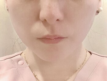 ミエリア美容鍼灸院(mielia美容鍼灸院)の写真/顔面余白をなくし、360度どこから見ても美しいフェイスラインへ！美容鍼灸が初めての方にも◎