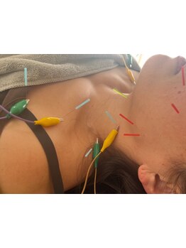 疲れを解消したい