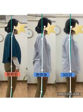 ニコ(niko)/肩こり・腰痛・猫背