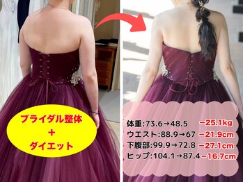 スリール(Sourire)の写真/【ドレス姿を綺麗に魅せたいプレ花嫁さん必見★】猫背や巻き肩でドレスが映えない‥そんなお悩み徹底改善♪