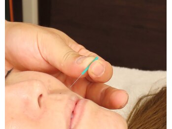 くすの木 治療院/美容鍼