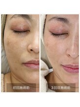 ボディーシェルター 横浜桜木町/グレーズピール