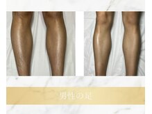 アンド エヌ(&n)/◆足脱毛◆