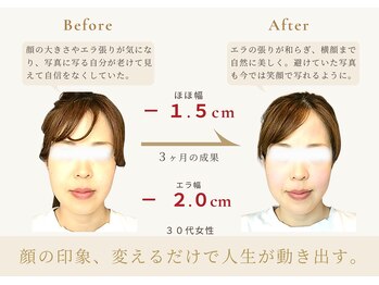 アロハ(ALOHA.)/印象美、変えるだけで人生が変化