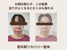 フロー(Flow)/1回で顔のたるみがスッキリ！