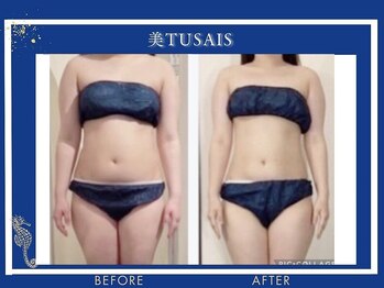 ビテュセ(美Tu sais)/【痩身・ダイエット】ボディケア