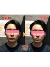 ヴィオーデ美容整体サロン 川越店/小顔、リンパ、ヘッドスパ、整体
