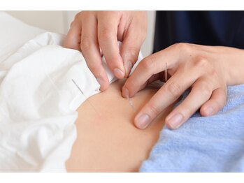 今津ぴっと骨盤整体院/鍼灸施術