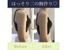 【最新マシーンで成功するダイエット】二の腕or背中の贅肉撃退コース￥9,350 
