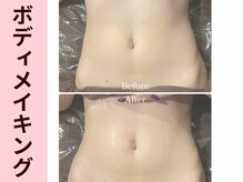 クイーンズチャーム(Queen's Charm)/パワーツリー★お腹