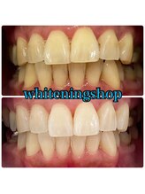 ホワイトニングショップ 吉祥寺2号店/妊婦さんも通えます