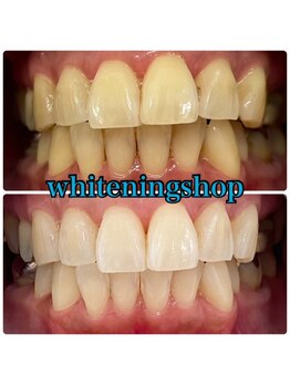 ホワイトニングショップ 吉祥寺2号店/妊婦さんも通えます