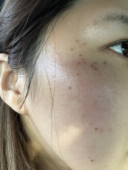 エコム(ECOM)/＼30分取り放題／