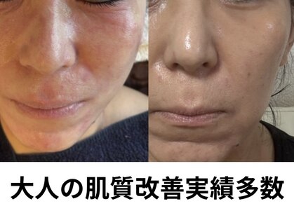 ジョーヌ(JAUNE)の写真