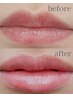 【ローマピンク★無料相談】当日施術OK♪くすんだ"唇"を赤ちゃんピンクに