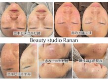 ラナン 岐阜(Ranan)
