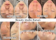 ラナン 岐阜(Ranan)