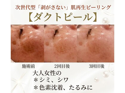 キノトミ(kinotomi)の写真