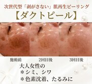 キノトミ(kinotomi)