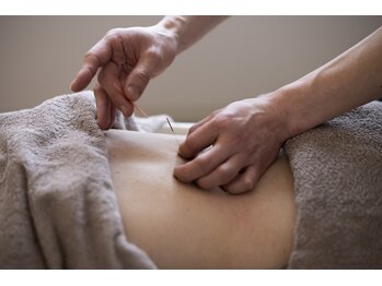 ホール 札幌円山(WHOLE)/すべて使い捨ての鍼を使用で清潔