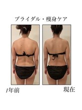 ファミーユ 新宿店/【INDIBA痩身】