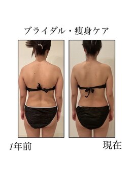 ファミーユ 新宿店/【INDIBA痩身】