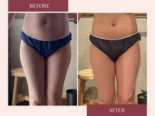 ドットカノア(.Kanoa)/お客様のbefore/after