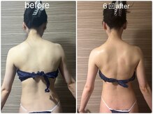 ライズサロン(RiseSALON)/ウェディングドレス対策