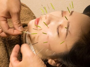慧仁治療院の写真/《口コミ高評価☆》むくみ・エラを改善し憧れの小顔へ。食いしばりによるエラやむくみでお悩みの方にも◎