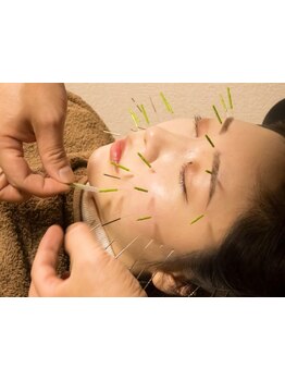 小顔になりたい