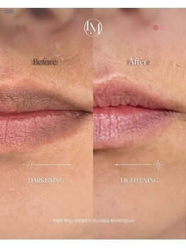 ミタス(Me+)/メラニンケア【ルメラ】唇