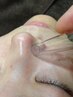 毛穴 角栓 皮脂詰まりケア※ディープケアの為SVと同時不可【9月末まで】