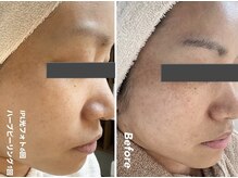 クロア ナゴヤ(Croire NAGOYA)/別人級の変化！