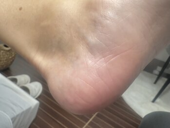 ルミエールサント(lumiere sainte)/スペシャルフットケアコース