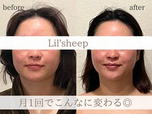 リルシープ(LIL'SHEEP)の雰囲気（小顔コルギ1回/小顔コルギ/ヘッドスパ/リンパマッサージ/今池）