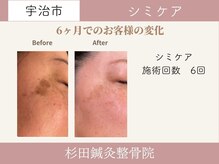 杉田鍼灸整骨院の雰囲気（レーザーは少し怖くて…。そんな方が多く来院されてます。）