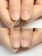 マリーロール 梅田店(Marie Laure)/自爪育成/深爪矯正/ネイルケア