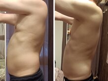 シャルマン(charmant)の雰囲気(グロッティプロで本気の痩身★福岡/久留米/花畑/痩身/リンパ)