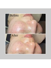 ブラックボックス(BLACK BOX)/東海村Ｋ様50代