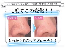 エムイーボーテ(me.Beaute)