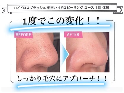 エムイーボーテ(me.Beaute)の写真