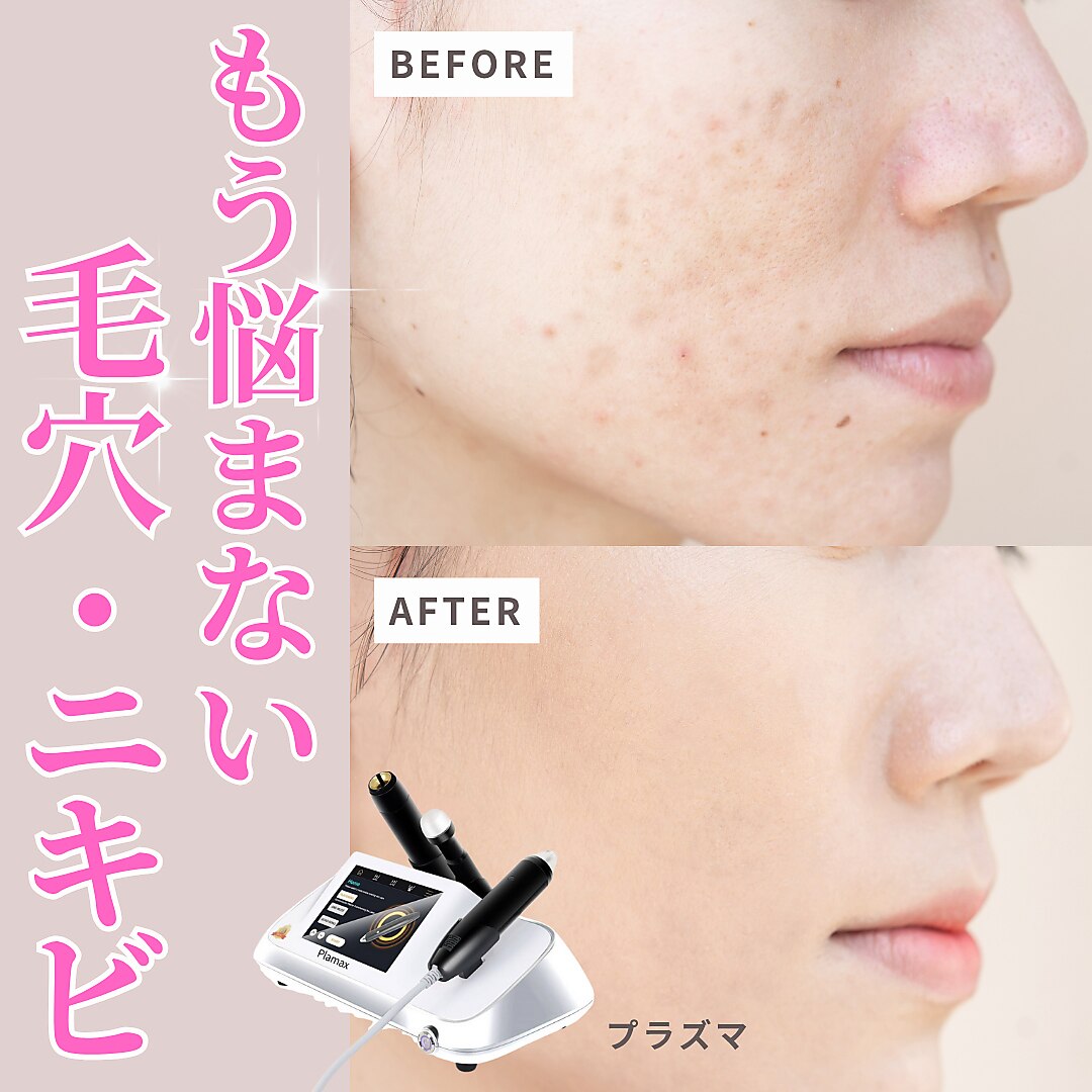 リボーン(REBORN)｜ホットペッパービューティー