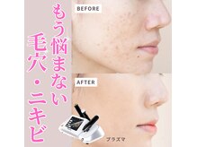 リボーン(REBORN)