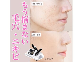 リボーン(REBORN)