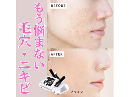 リボーン(REBORN)の写真