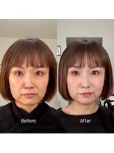 ハッピーアリスター(HAPPY ALISTER)/メイクビフォーアフター